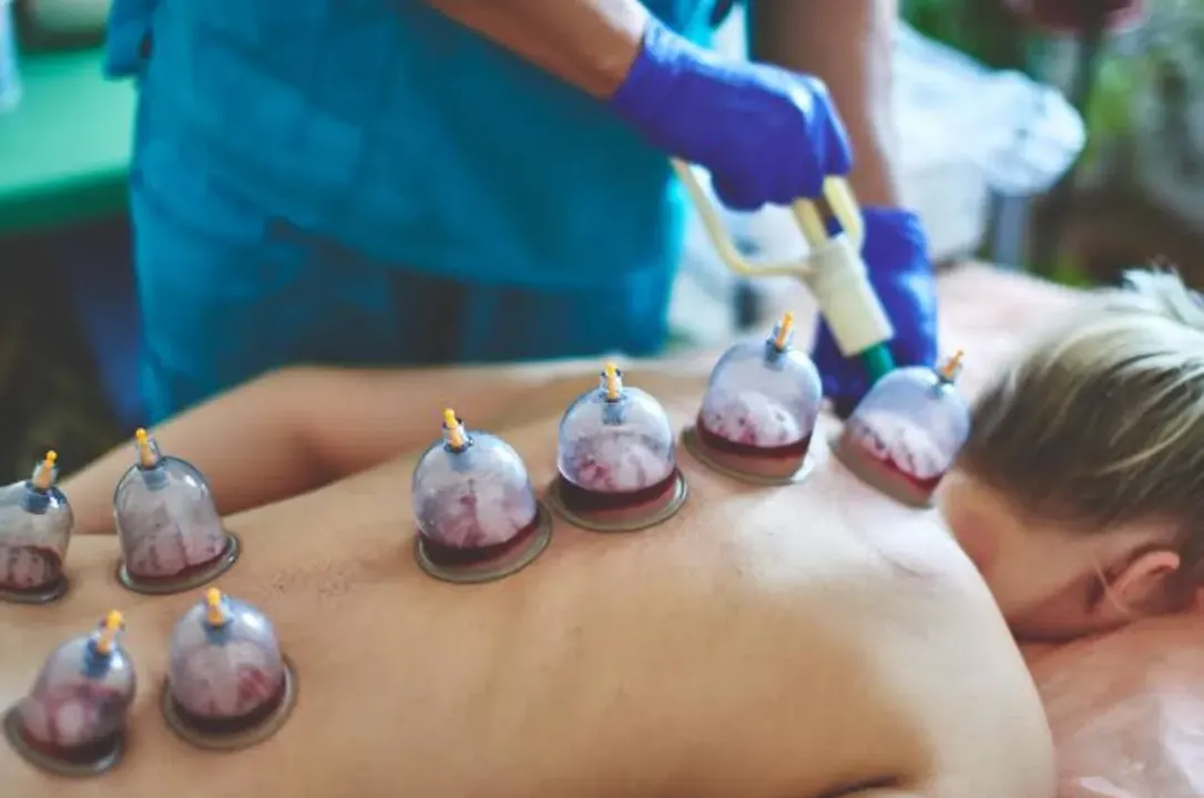 BLOOD CUPPING