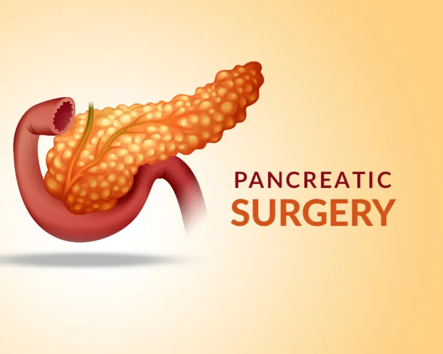 Pancreatic Surgeries