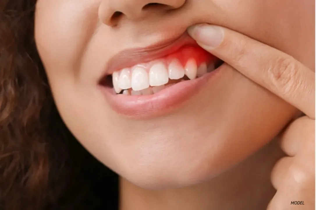 Periodontics (gum treatment)